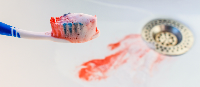 Closeup of a bloody toothbrush with blood in the sink from bleeding gums
