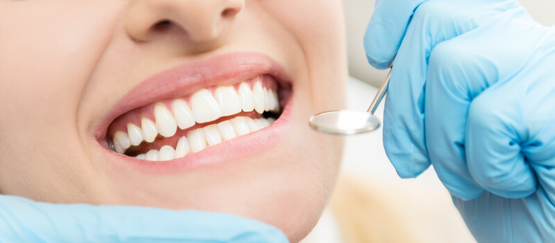 Closeup of a woman smiling after receiving a deep cleaning at the dentist in Liberty, MO